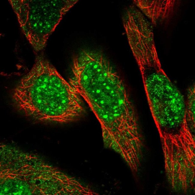 ZNF169 Antibody in Immunocytochemistry (ICC/IF)