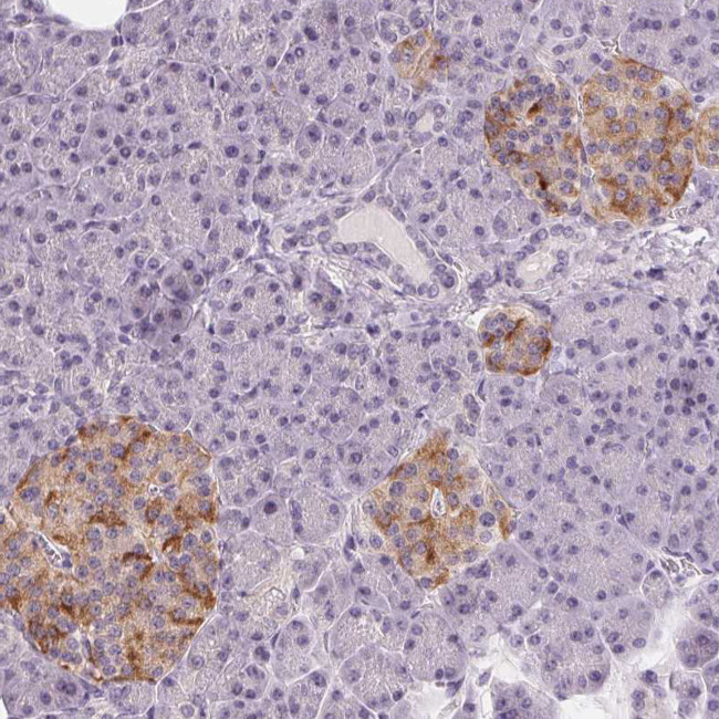 Cryptic Antibody in Immunohistochemistry (Paraffin) (IHC (P))