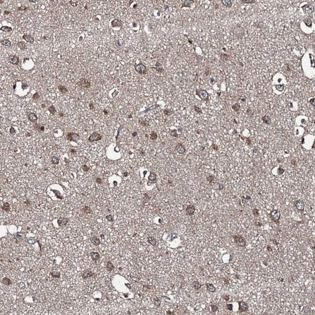 SNX32 Antibody in Immunohistochemistry (Paraffin) (IHC (P))