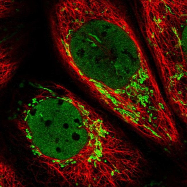 CARS2 Antibody in Immunocytochemistry (ICC/IF)