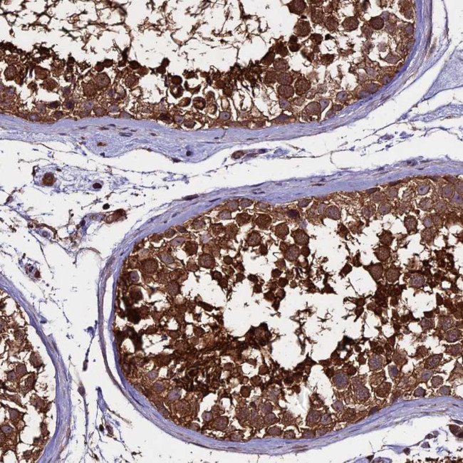 PGPEP1L Antibody in Immunohistochemistry (Paraffin) (IHC (P))