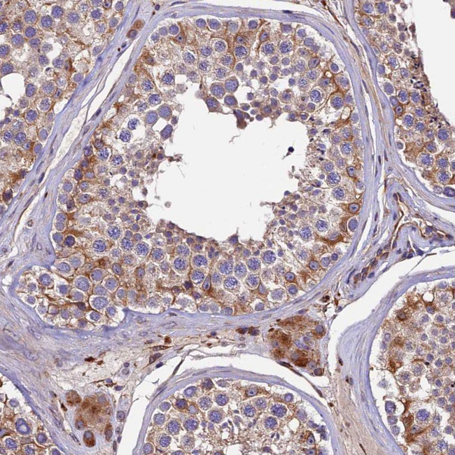 CLN5 Antibody in Immunohistochemistry (Paraffin) (IHC (P))