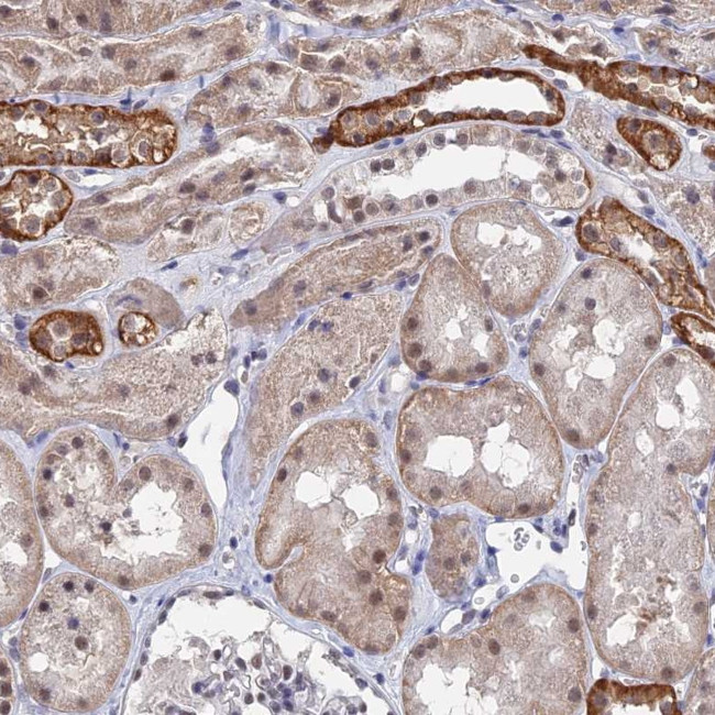 TSSC4 Antibody in Immunohistochemistry (Paraffin) (IHC (P))