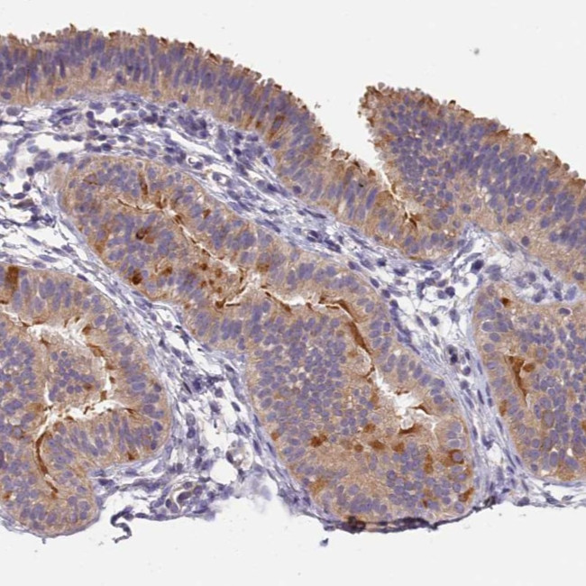 C15orf26 Antibody in Immunohistochemistry (Paraffin) (IHC (P))