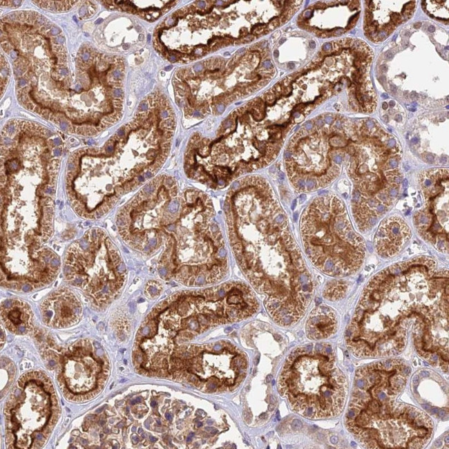 TBC1D1 Antibody in Immunohistochemistry (Paraffin) (IHC (P))