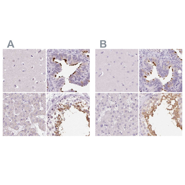 ROPN1L Antibody in Immunohistochemistry (IHC)