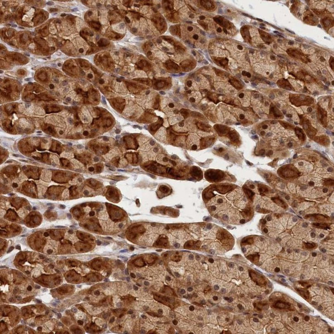 CEP44 Antibody in Immunohistochemistry (IHC)