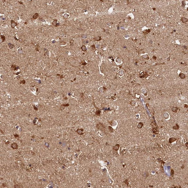 Katanin p80 Antibody in Immunohistochemistry (Paraffin) (IHC (P))