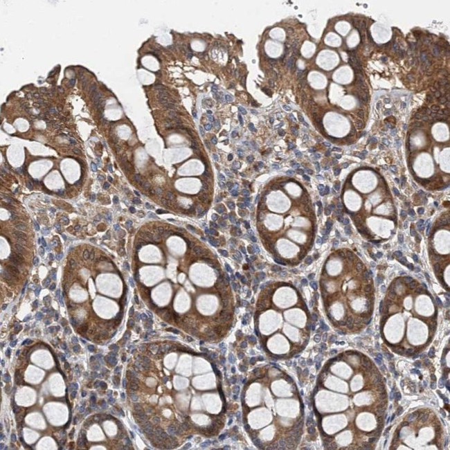 PPP1R14D Antibody in Immunohistochemistry (IHC)