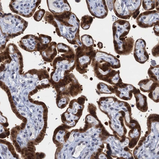 EPS8L1 Antibody in Immunohistochemistry (Paraffin) (IHC (P))