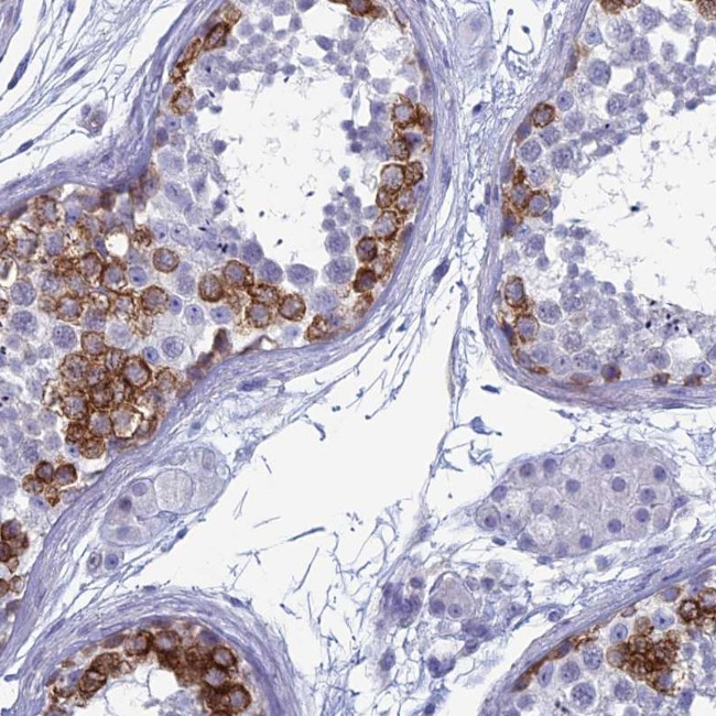 MAGEB6 Antibody in Immunohistochemistry (Paraffin) (IHC (P))