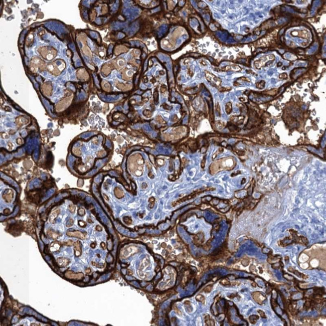 MYADML2 Antibody in Immunohistochemistry (Paraffin) (IHC (P))