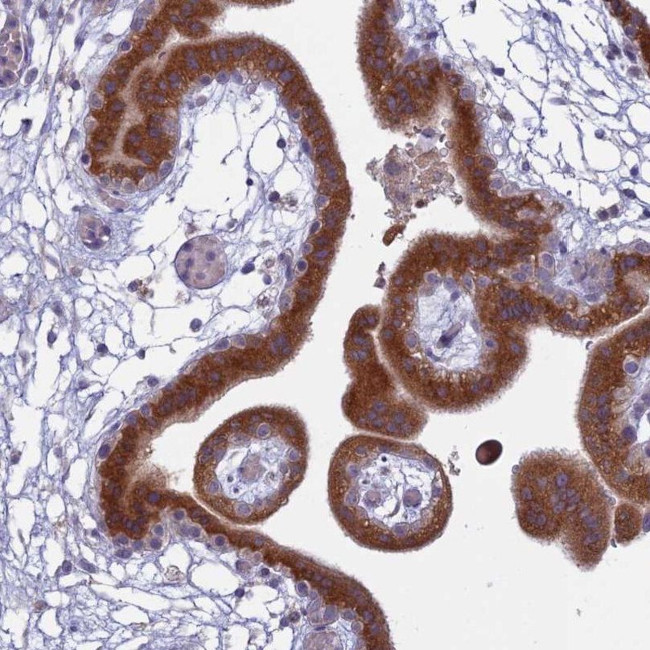 TMEM208 Antibody in Immunohistochemistry (IHC)