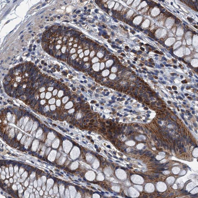 DDX49 Antibody in Immunohistochemistry (Paraffin) (IHC (P))