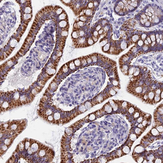 AP4E1 Antibody in Immunohistochemistry (Paraffin) (IHC (P))