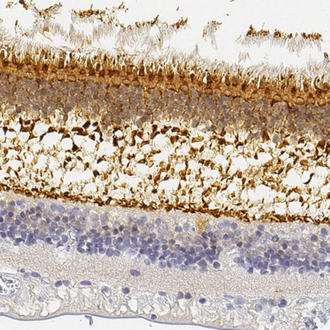 UNC119 Antibody in Immunohistochemistry (IHC)