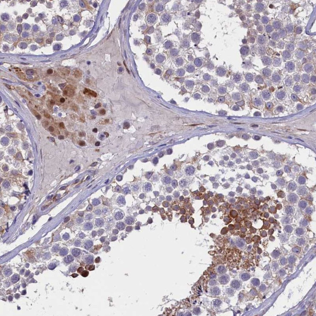 PDILT Antibody in Immunohistochemistry (Paraffin) (IHC (P))