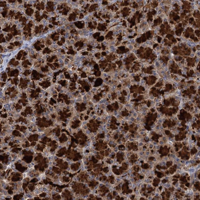 WDR88 Antibody in Immunohistochemistry (Paraffin) (IHC (P))