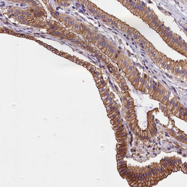 BLACE Antibody in Immunohistochemistry (Paraffin) (IHC (P))