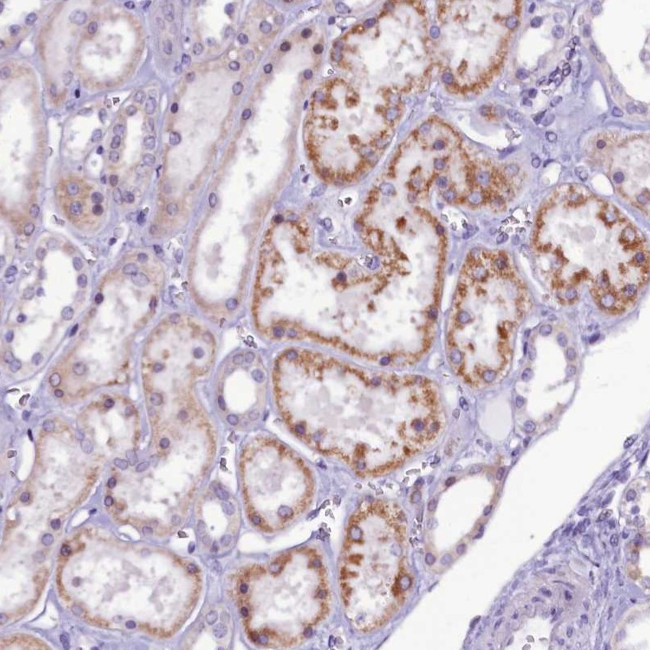 CCDC106 Antibody in Immunohistochemistry (Paraffin) (IHC (P))