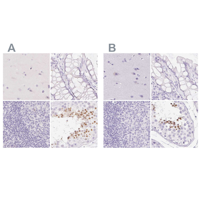 SPACA4 Antibody in Immunohistochemistry (IHC)