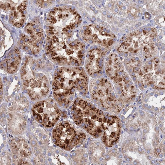 RPUSD1 Antibody in Immunohistochemistry (Paraffin) (IHC (P))