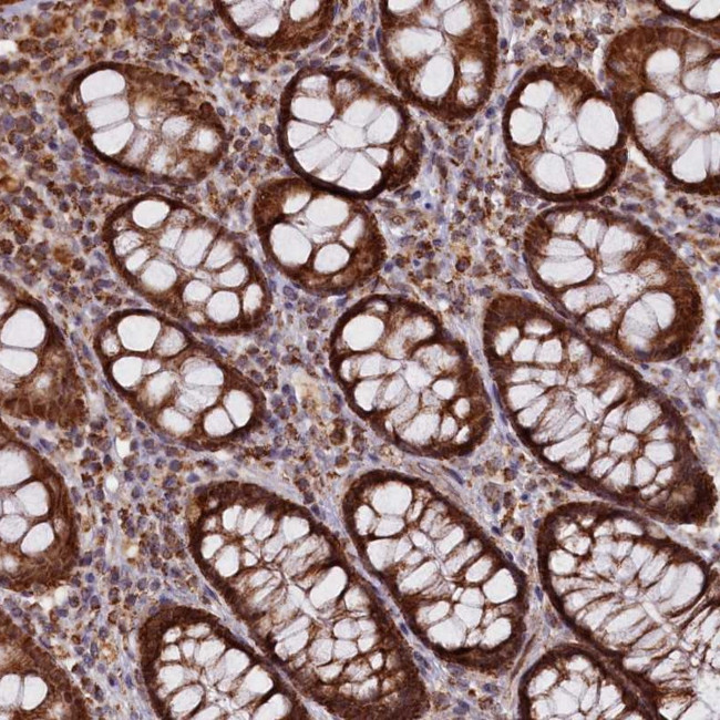 DUS3L Antibody in Immunohistochemistry (Paraffin) (IHC (P))