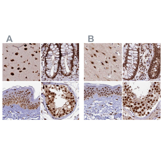 FAM103A1 Antibody in Immunohistochemistry (IHC)