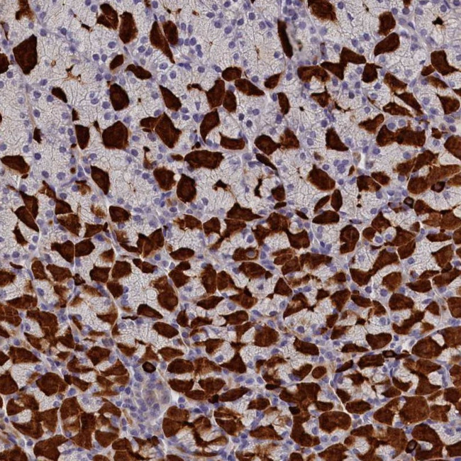 Rotatin Antibody in Immunohistochemistry (Paraffin) (IHC (P))