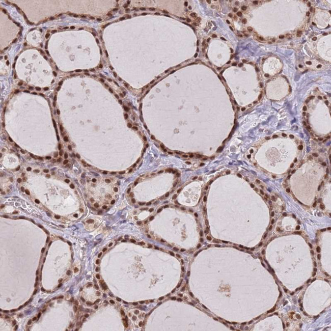 SDS3 Antibody in Immunohistochemistry (Paraffin) (IHC (P))