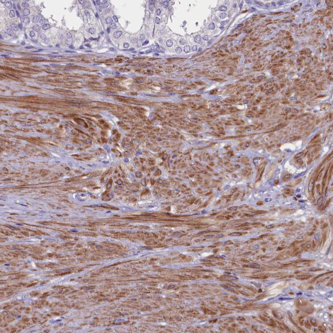 HEATR3 Antibody in Immunohistochemistry (Paraffin) (IHC (P))