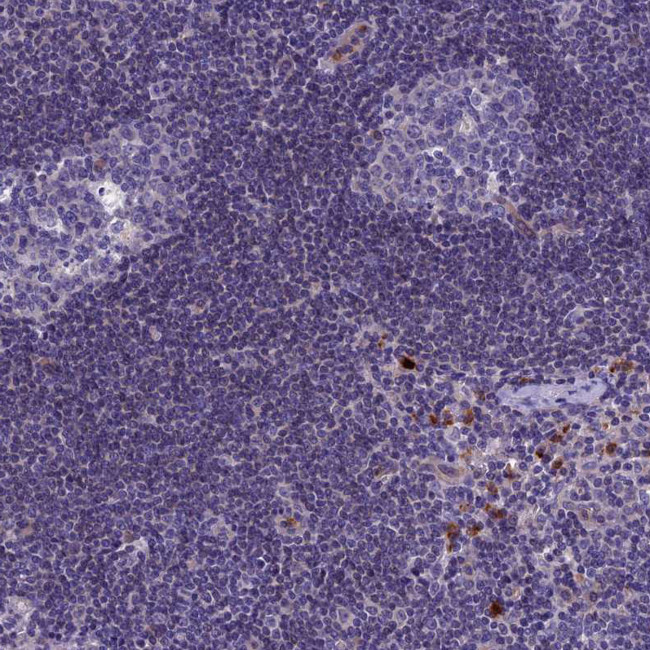 C19orf48 Antibody in Immunohistochemistry (Paraffin) (IHC (P))