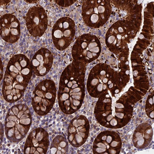 DCTN5 Antibody in Immunohistochemistry (Paraffin) (IHC (P))