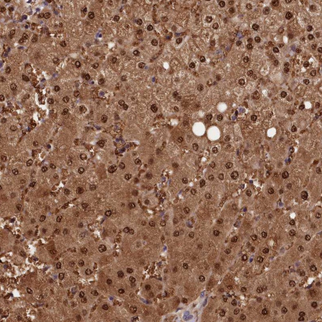 PAPL Antibody in Immunohistochemistry (Paraffin) (IHC (P))