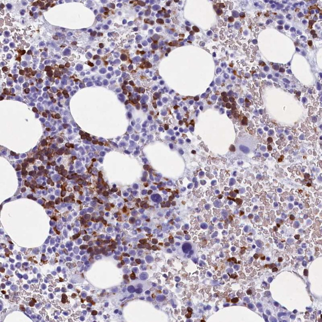 C16orf96 Antibody in Immunohistochemistry (Paraffin) (IHC (P))