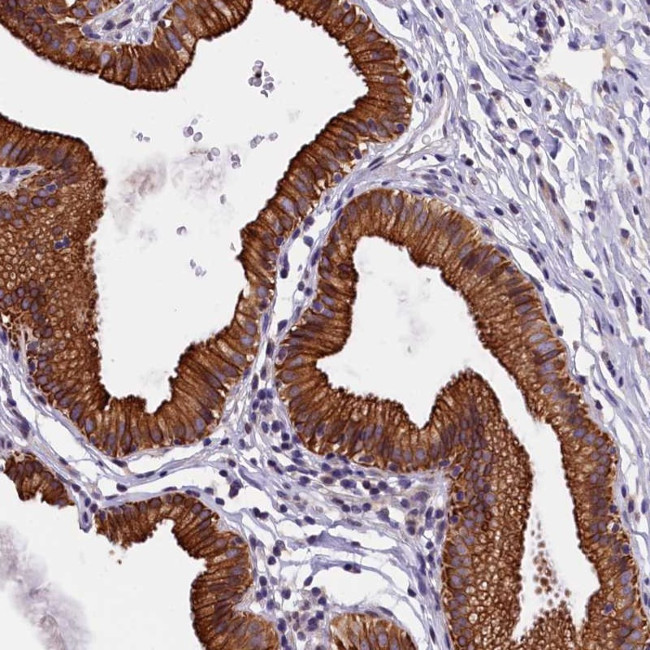 NXNL1 Antibody in Immunohistochemistry (Paraffin) (IHC (P))