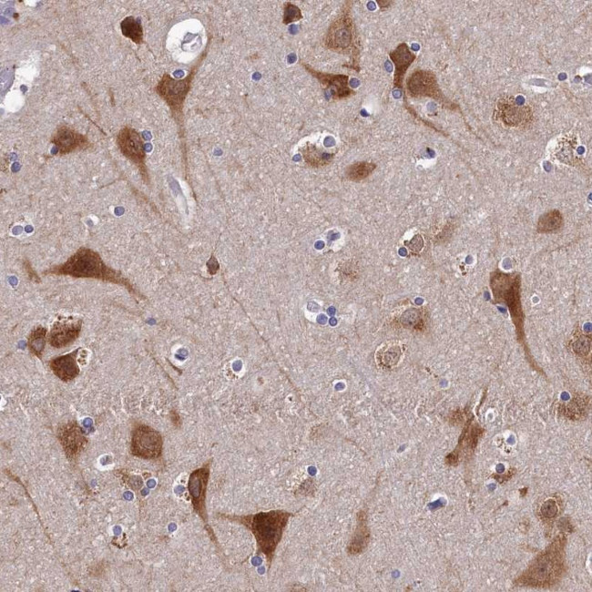 BRUNOL5 Antibody in Immunohistochemistry (Paraffin) (IHC (P))
