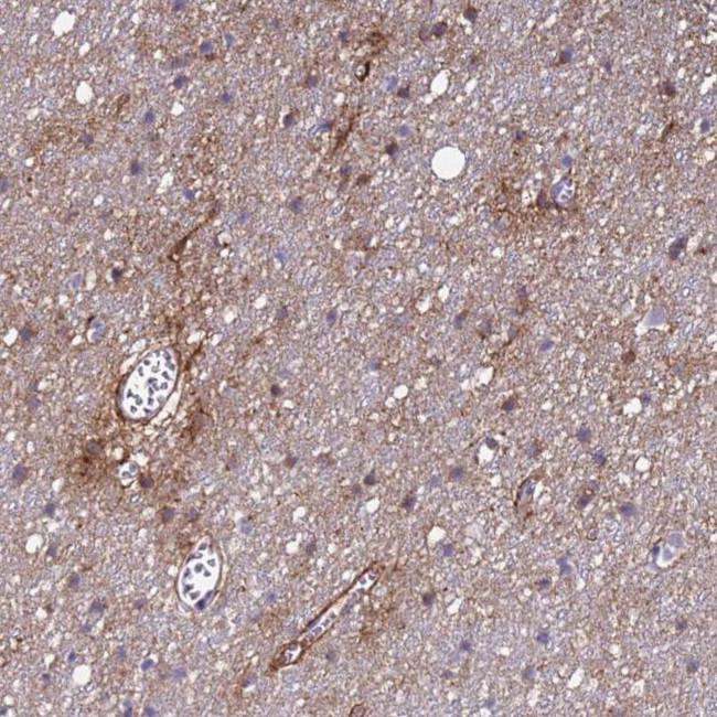 P2X7 Antibody in Immunohistochemistry (IHC)