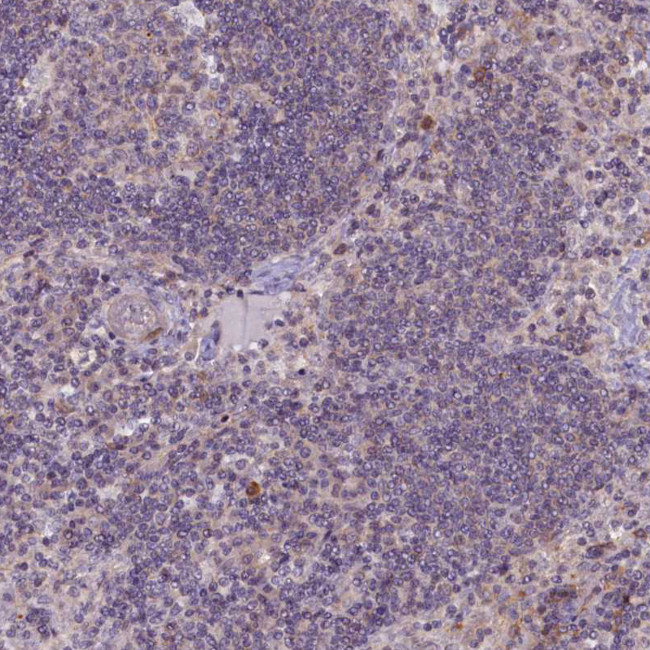 CCL23 Antibody in Immunohistochemistry (Paraffin) (IHC (P))