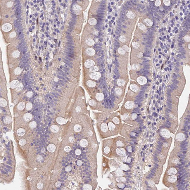 MIDN Antibody in Immunohistochemistry (Paraffin) (IHC (P))