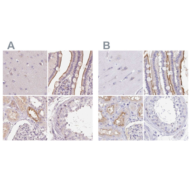 TREH Antibody in Immunohistochemistry (IHC)