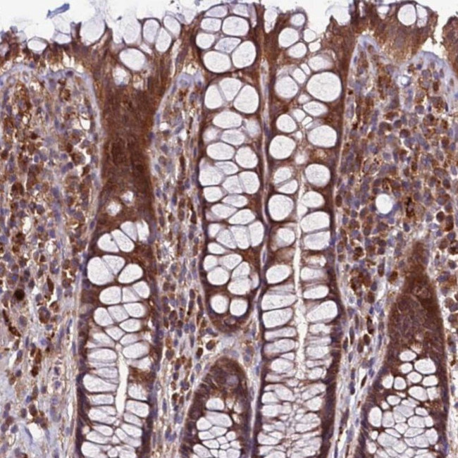 FAM59A Antibody in Immunohistochemistry (IHC)