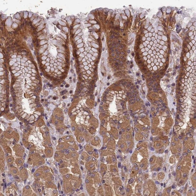 CHD9 Antibody in Immunohistochemistry (IHC)