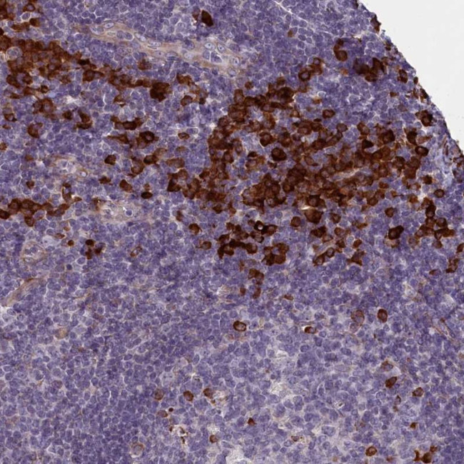 C16orf96 Antibody in Immunohistochemistry (Paraffin) (IHC (P))