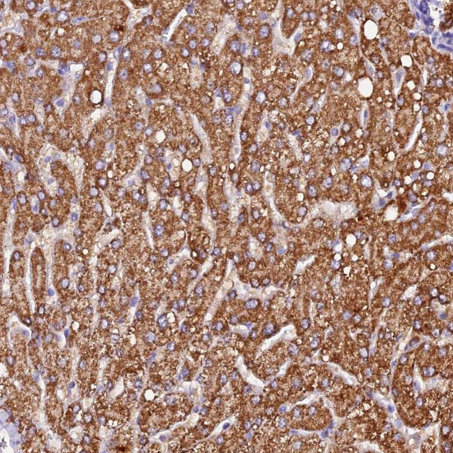 SIX5 Antibody in Immunohistochemistry (Paraffin) (IHC (P))