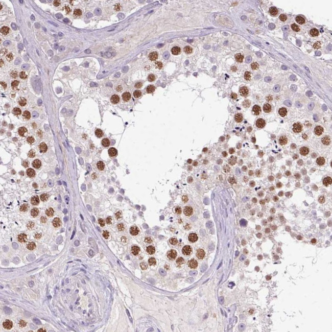 SYCE2 Antibody in Immunohistochemistry (Paraffin) (IHC (P))