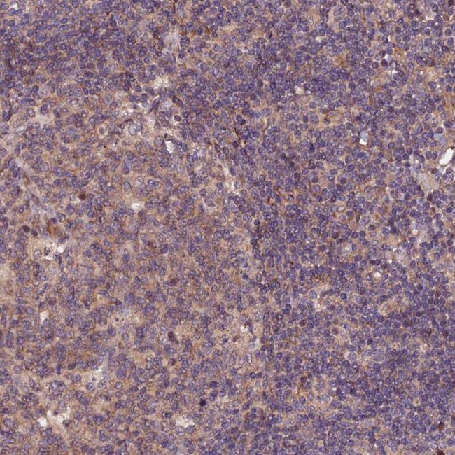 RINL Antibody in Immunohistochemistry (IHC)