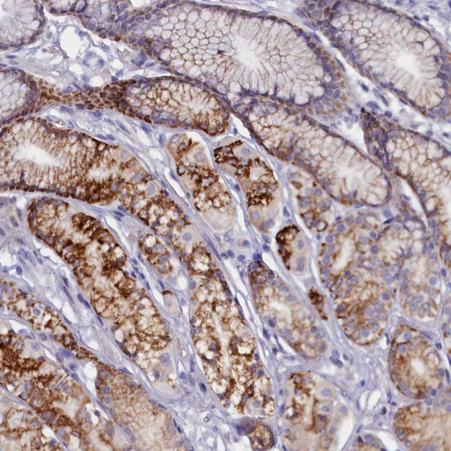 ZSWIM4 Antibody in Immunohistochemistry (Paraffin) (IHC (P))