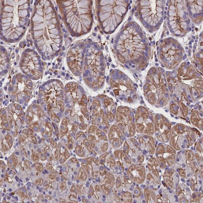 ZNF749 Antibody in Immunohistochemistry (IHC)