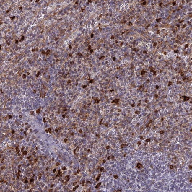 APOB48R Antibody in Immunohistochemistry (Paraffin) (IHC (P))